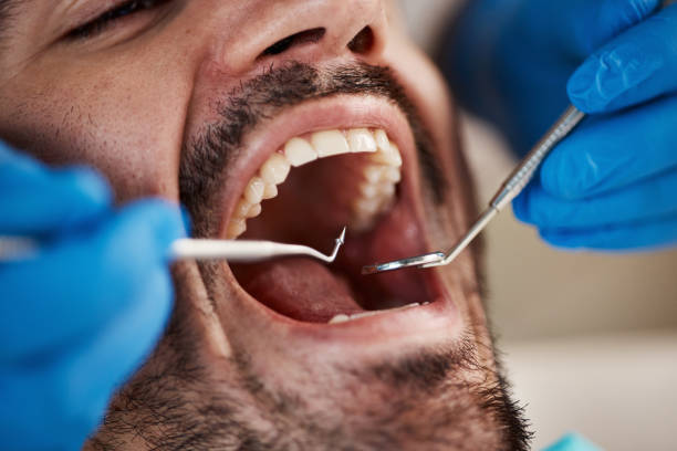 Best Emergency Dentist Open Today  in Edgemere, MD