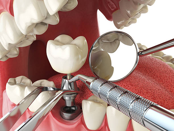 Best Cracked Tooth Emergency Dentist  in Edgemere, MD