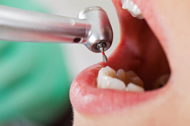 Best Cracked Tooth Emergency Dentist  in Edgemere, MD